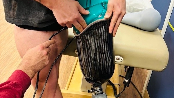 SFU researchers break the mould with new prosthetic design